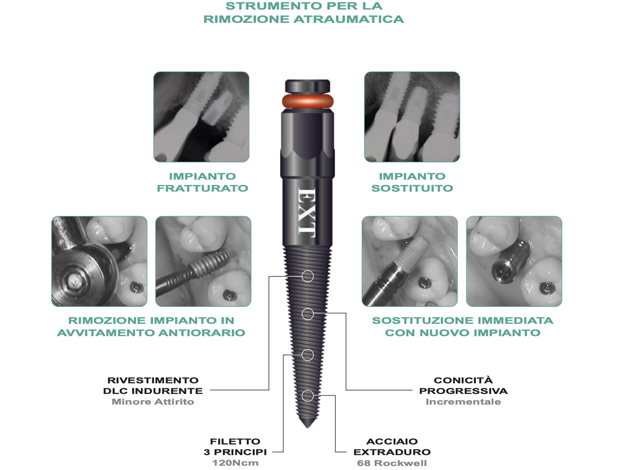 Connection Internal Hexagon IK – IC - IA - RESISTA